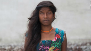 Illustration for article titled Acid Attack Survivors Model for New Photo Shoot